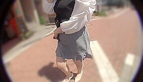 J-A Married Woman Who Has Become A Generalized Sensitive Zone